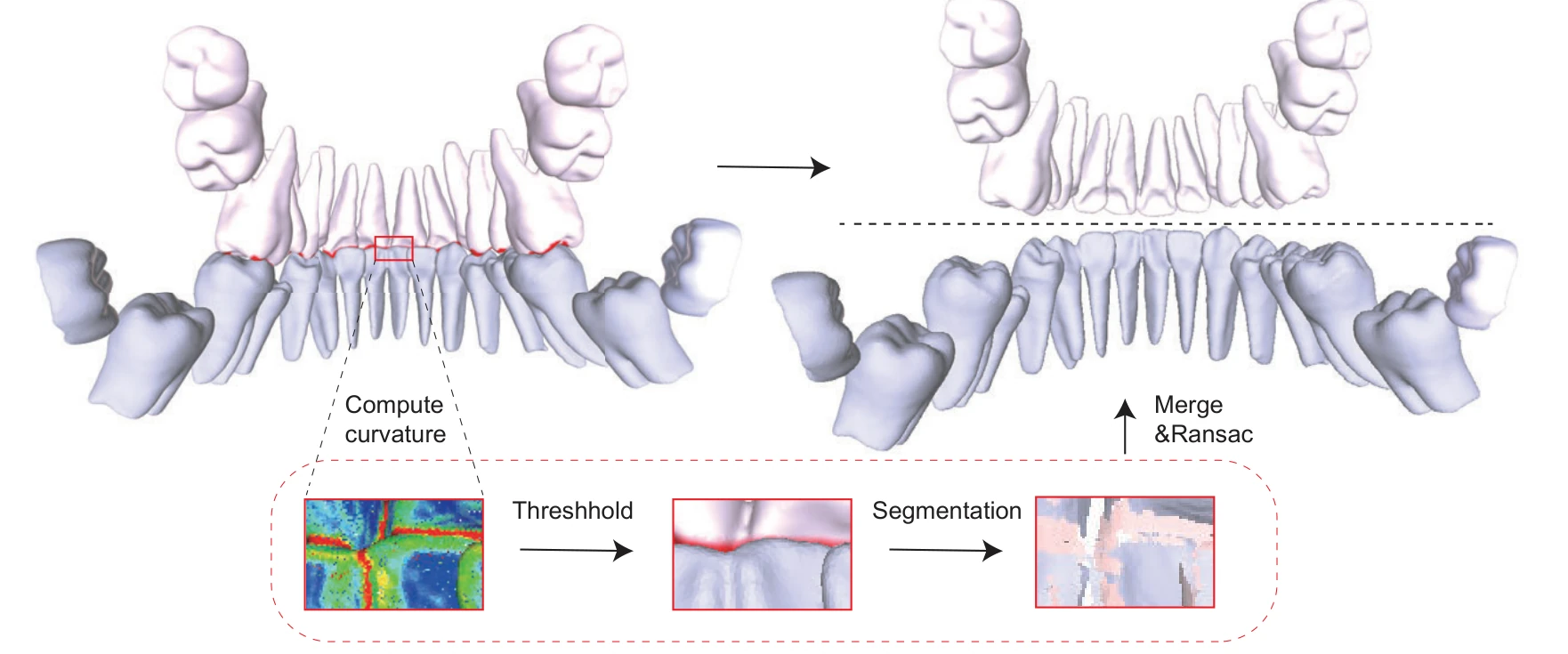 左图为上下颌牙齿相互接触的 CBCT 模型,局部区域以方框标出;下方依次为曲率着色图、阈值处理后的局部和分割后的局部。右图为分离后的同一副牙列,上下颌沿虚线分开。