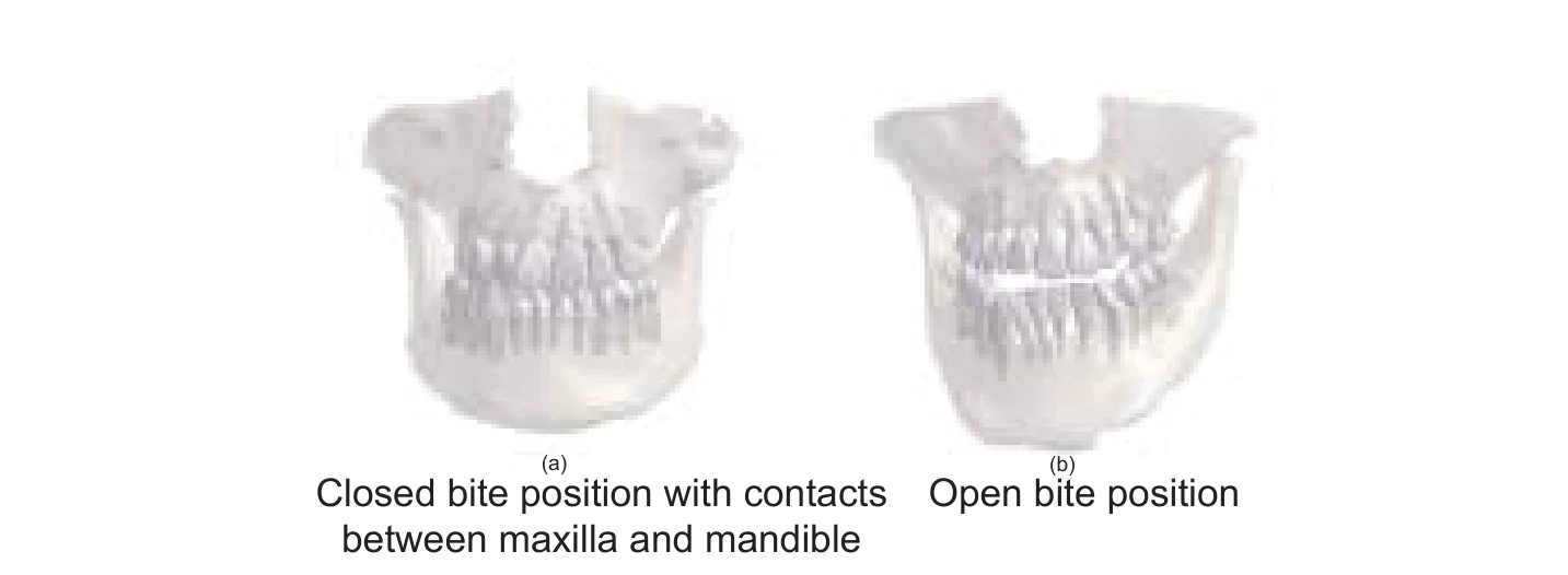 两个灰色的颌骨与牙列 CBCT 三维重建。左图为咬合状态,上下牙列相互接触;右图为轻微张口,上下牙列之间可见间隙。